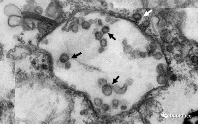 胆小又害羞的穿山甲，被人类贴上通乳壮阳的诅咒，每5分钟被抓1只