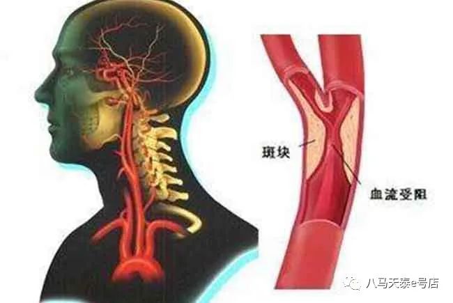 铁观音降压效果怎么样？铁观音的什么元素能降压？