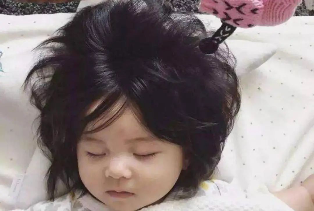 从头发看五脏，枯黄脱发白发是哪个脏有问题？